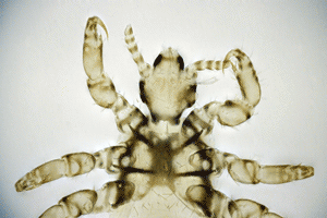louse_300px.gif